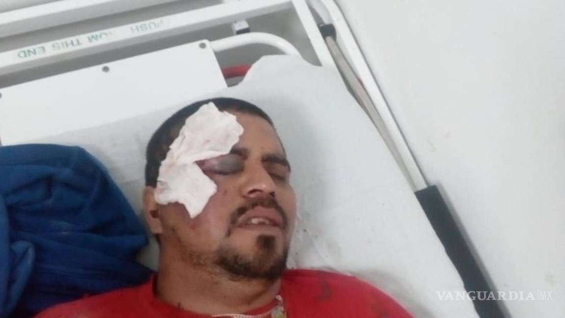 Ebrio cae de moto en calles de Parras y sufre varias fracturas
