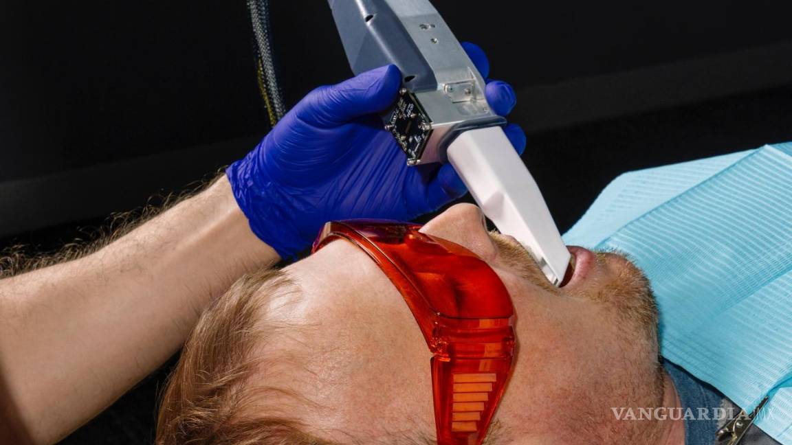 $!Escaneo de la cavidad oral del paciente.