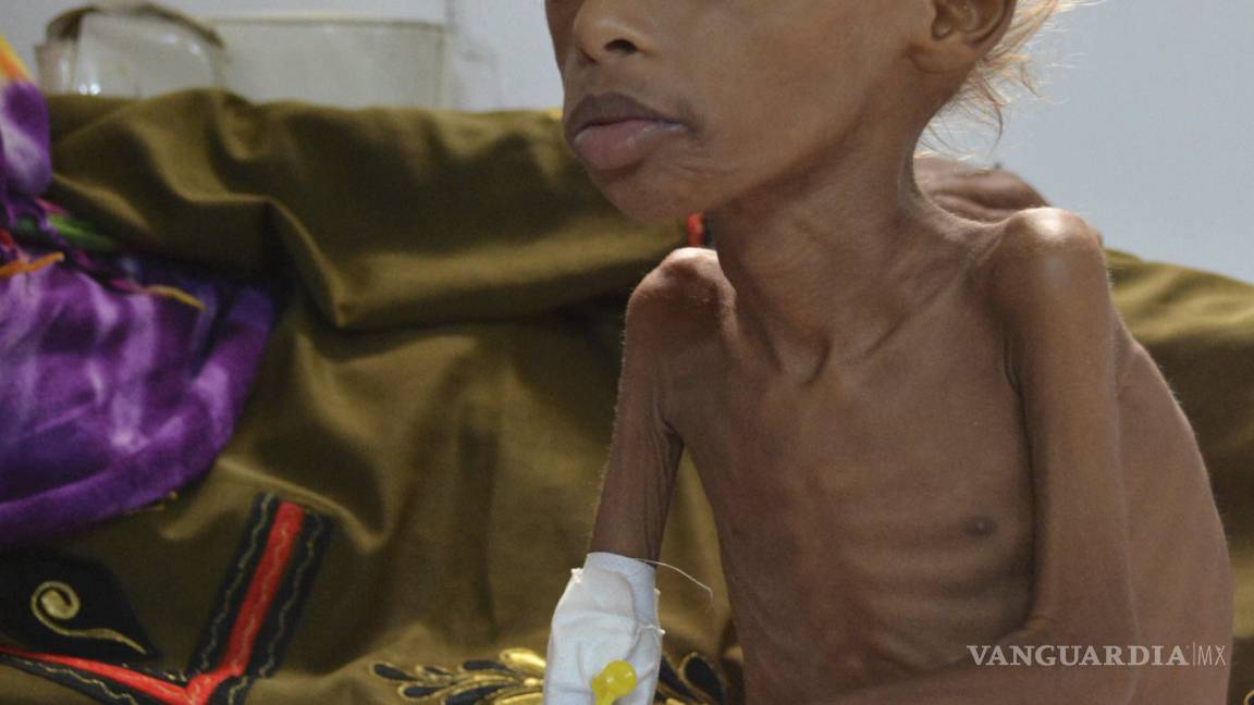 $!130 niños o más mueren cada día en Yemen: Save the Children
