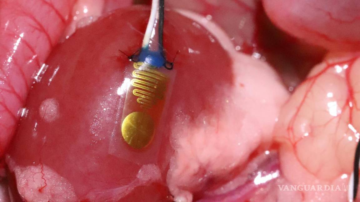 $!Dispositivo implantado en un riñón de roedor (cobayo).