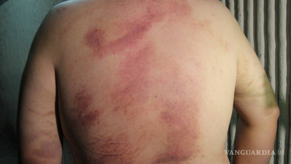 $!Vinculan a proceso a policías por tortura y abuso de autoridad en Saltillo