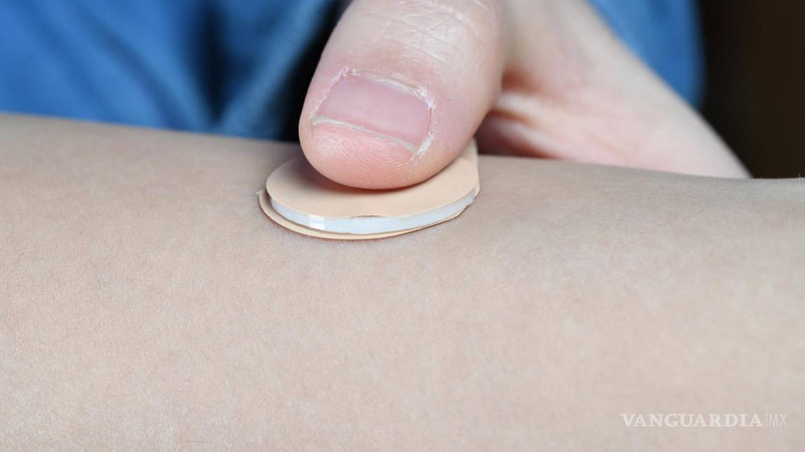 $!Desarrollan científicos un parche anticonceptivo de efecto prolongado