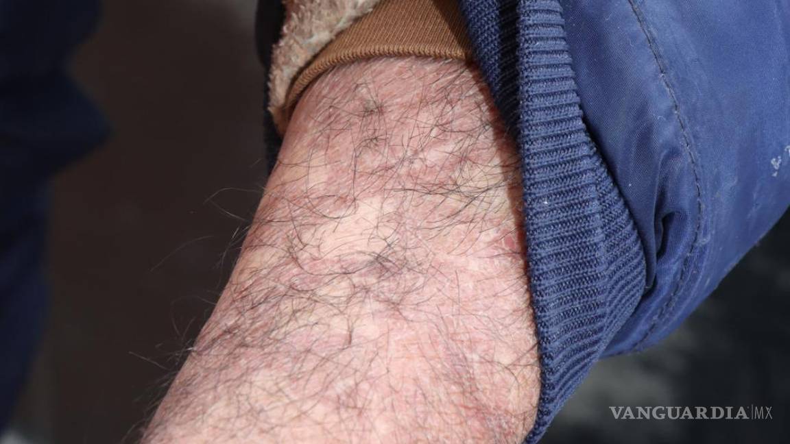 $!Don José Cruz exige se aplique la justicia contra quienes lo agredieron.