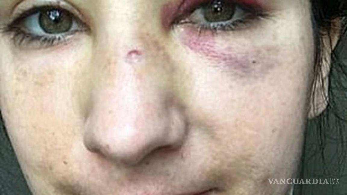 $!Golpean brutalmente a azafata y su novia en autobús de Londres, querían obligarlas a besarse