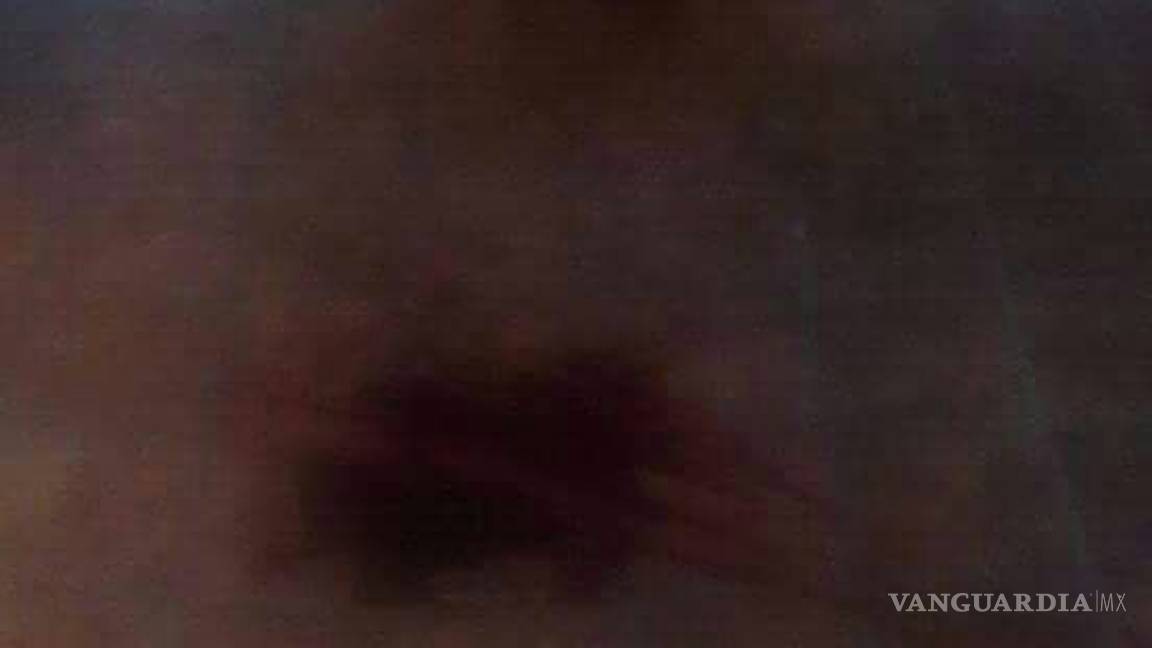 $!Denuncian que mujer muere desangrada en el IMSS de Parras por falta de atención