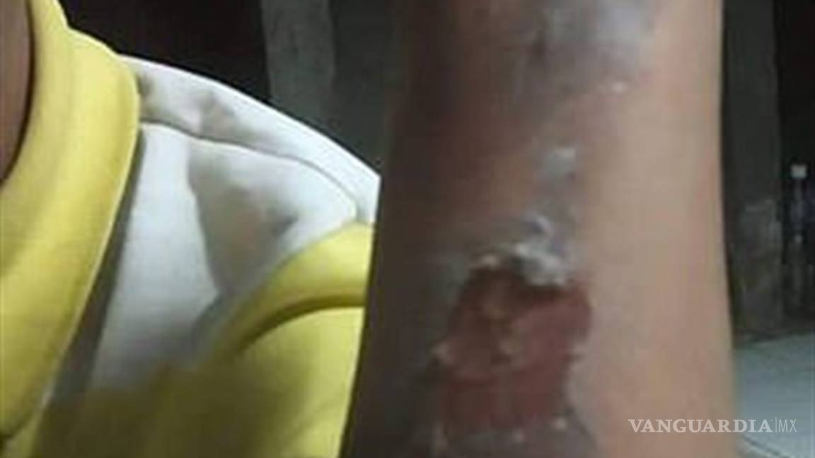 $!'Broma' de niños deja a vendedor de globos envuelto en llamas