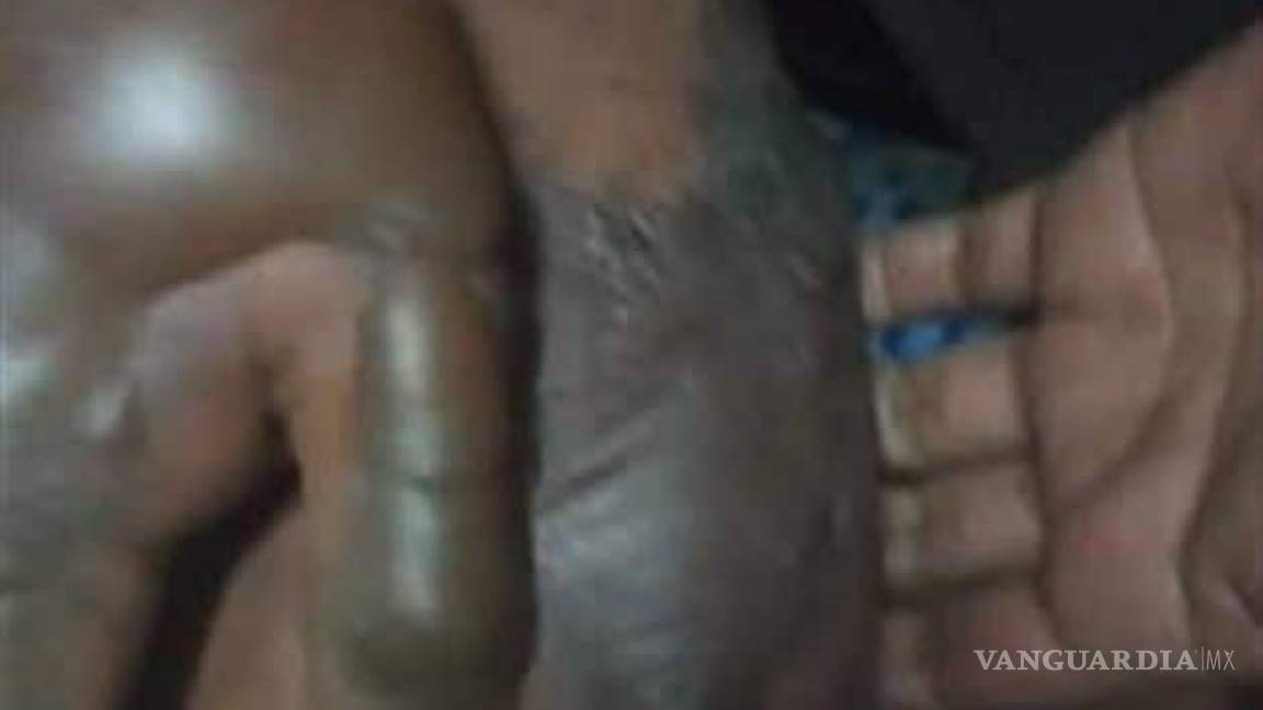 $!'Broma' de niños deja a vendedor de globos envuelto en llamas