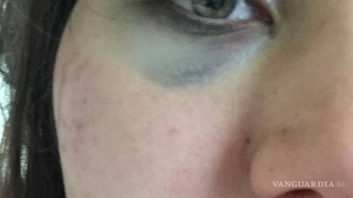 $!Se vuelve viral denuncia de saltillense golpeada por ‘cortar’ a su novio