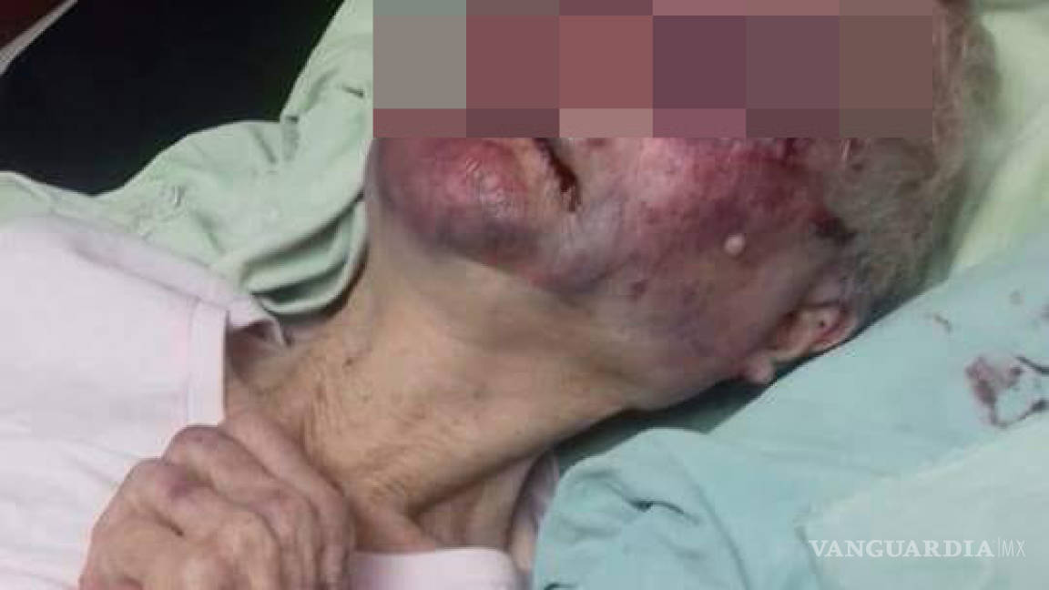 Estable, anciana ‘golpeada’ en Frontera, Coahuila