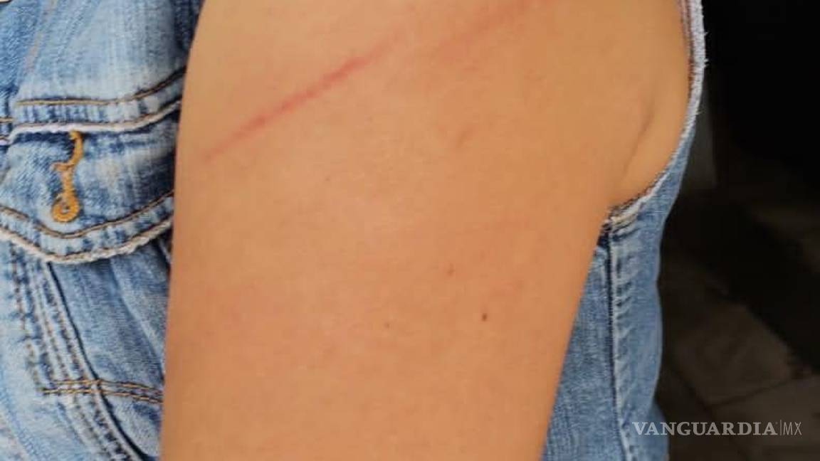 $!Iris acudió a las instalaciones del Centro de Justicia y Empoderamiento de la Mujer donde interpondrá la denuncia correspondiente solicitando una orden de restricción por temor de su integridad física.