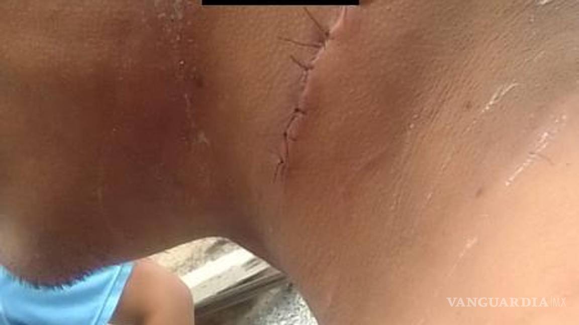 $!Edgar recibió atención médica urgente debido a una herida en el cuello que afectó una vena.