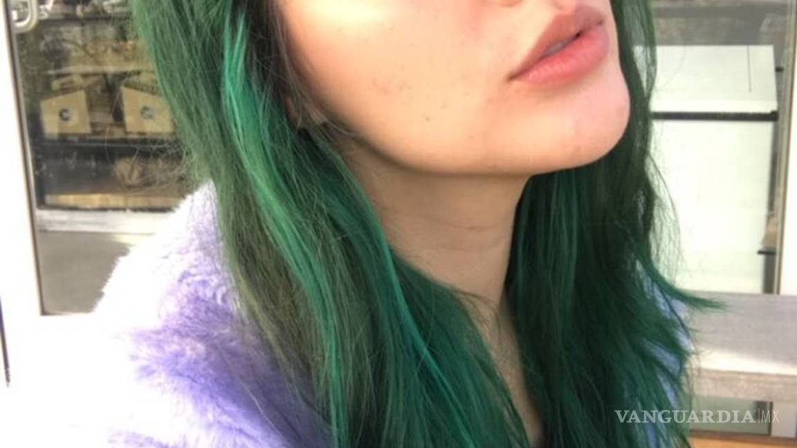 $!Joven acusa a cantante de “The Voice”, antes mejor amiga, de haberla violado