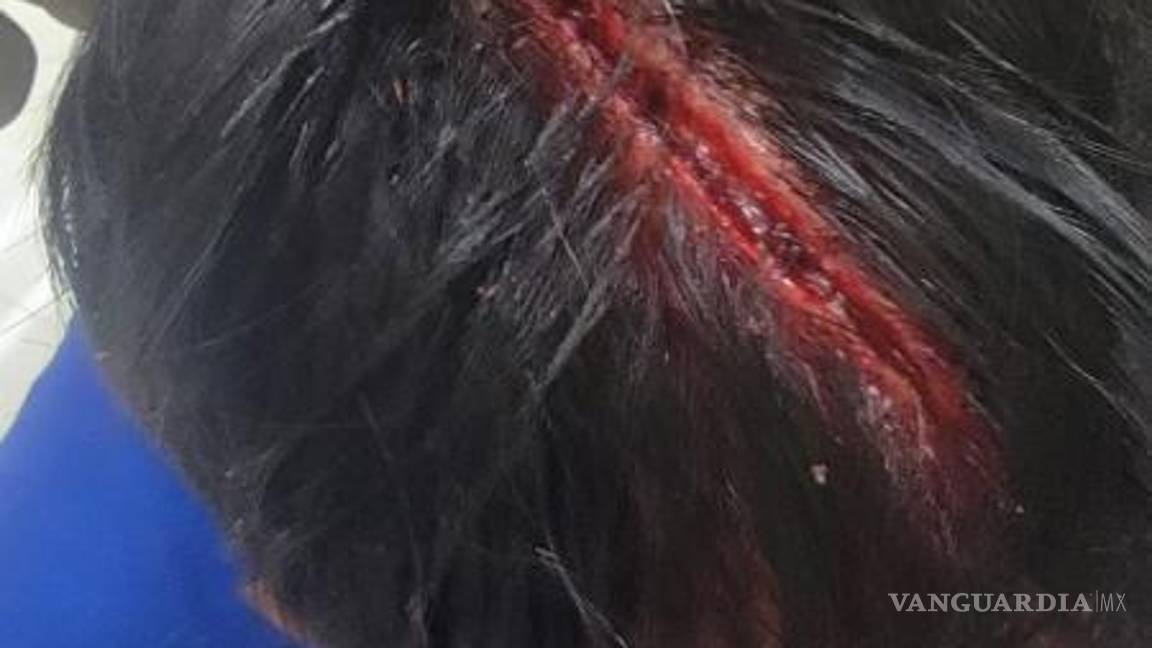 $!La familia de José Omar denunció el brutal ataque que sufrió a manos de un policía municipal, quien utilizó un bate para agredirlo.