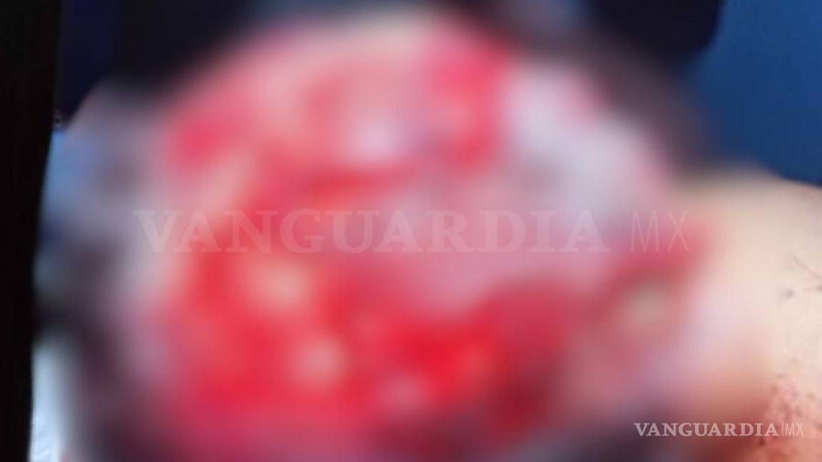 $!Las graves lesiones en el cuero cabelludo mantuvieron a la menor en el quirófano durante seis horas.