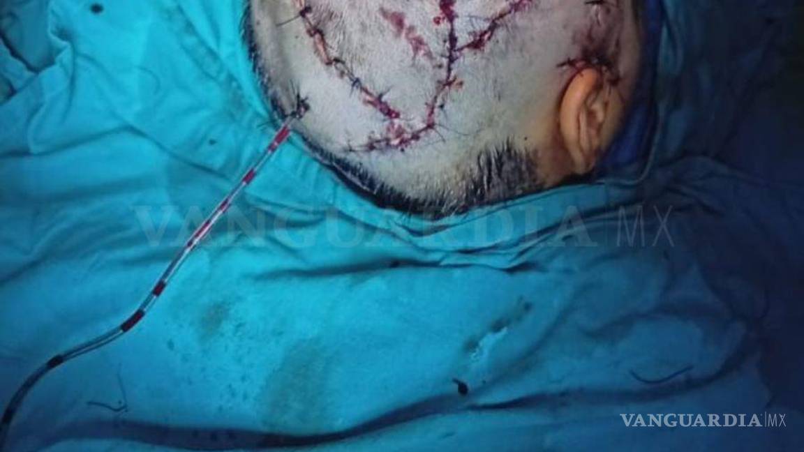 $!La menor se recupera satisfactoriamente tras una cirugía reconstructiva que requirió 68 puntos de sutura.