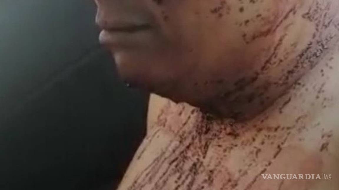 $!Fotos de Ingrid, desollada y asesinada por su pareja, fueron filtradas; estalla indignación