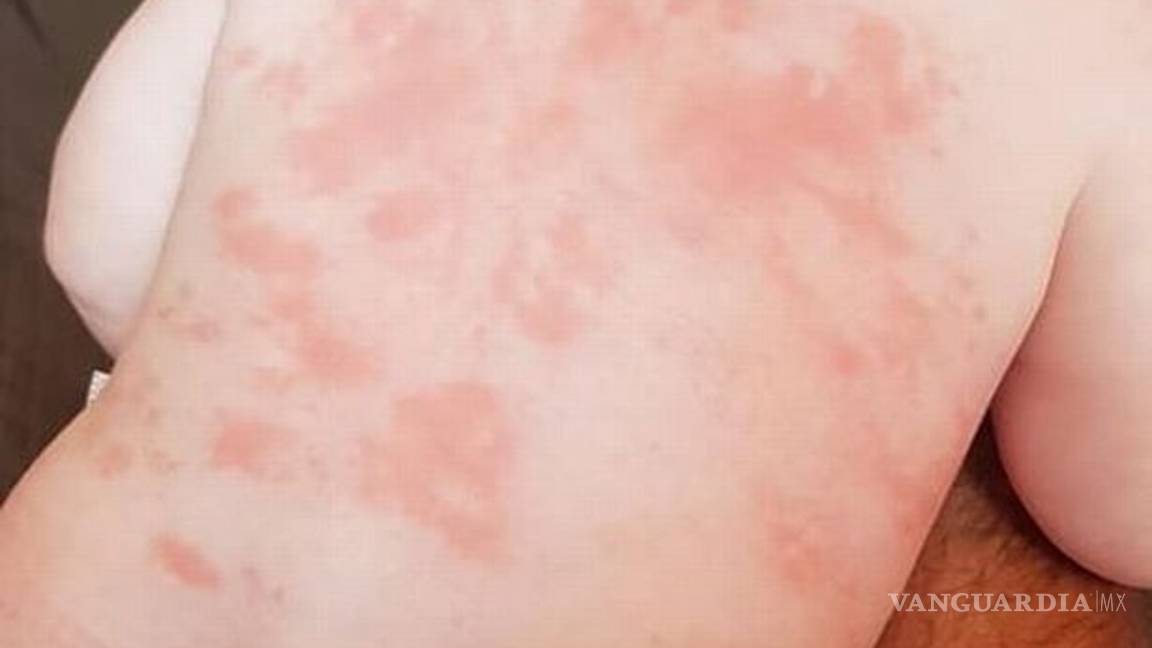 $!Bebé de 5 meses se contagió de coronavirus, ahora está enferma del corazón de por vida