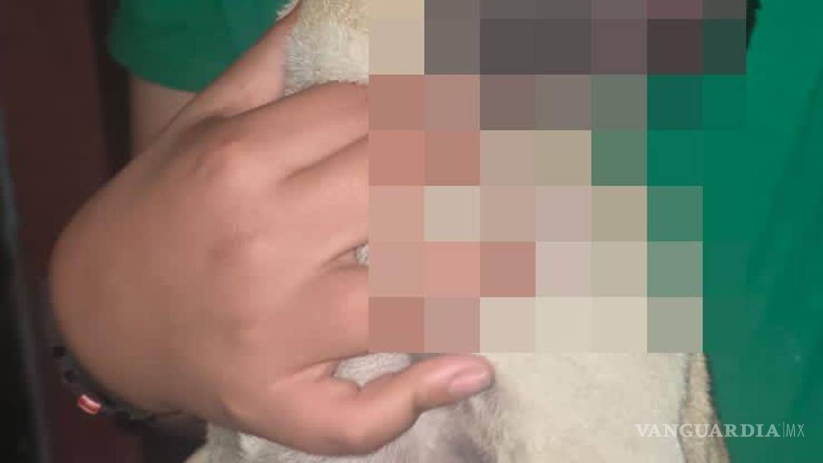 $!El perro resultó con quemaduras tras el flamazo provocado por una fuga de gas en un domicilio de la colonia Bellavista.