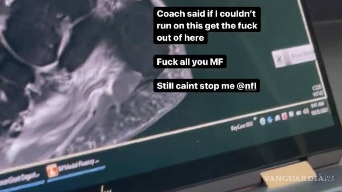 $!Brown posteó la imagen de una radiografía y una serie de mensajes contra los Bucs.