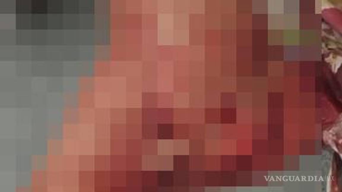 $!Bryan Alberto ¨N¨ fue atendido en el lugar antes de ser enviado a su domicilio para descansar después de recibir curaciones en el pie.