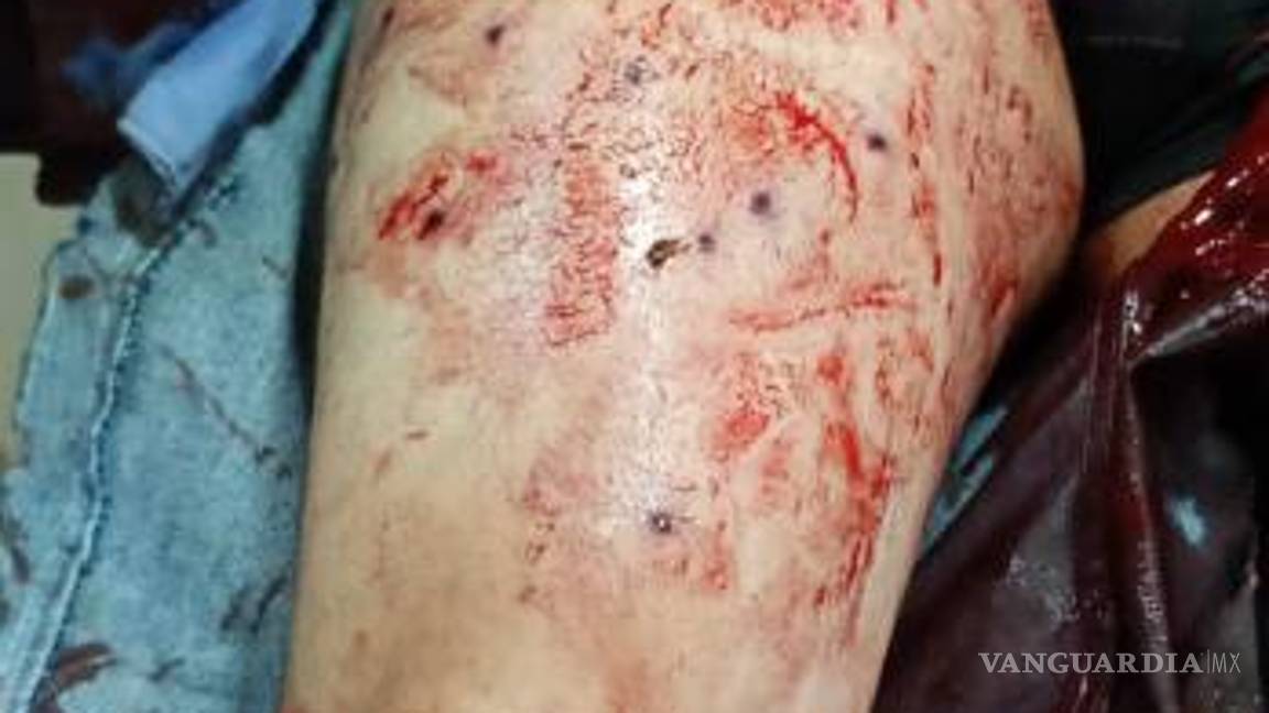 $!Juan Daniel Reyes Medrano resultó con once heridas de bala en la pierna derecha.