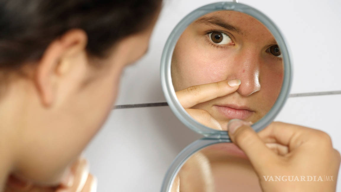 3 recetas para luchar contra el acné