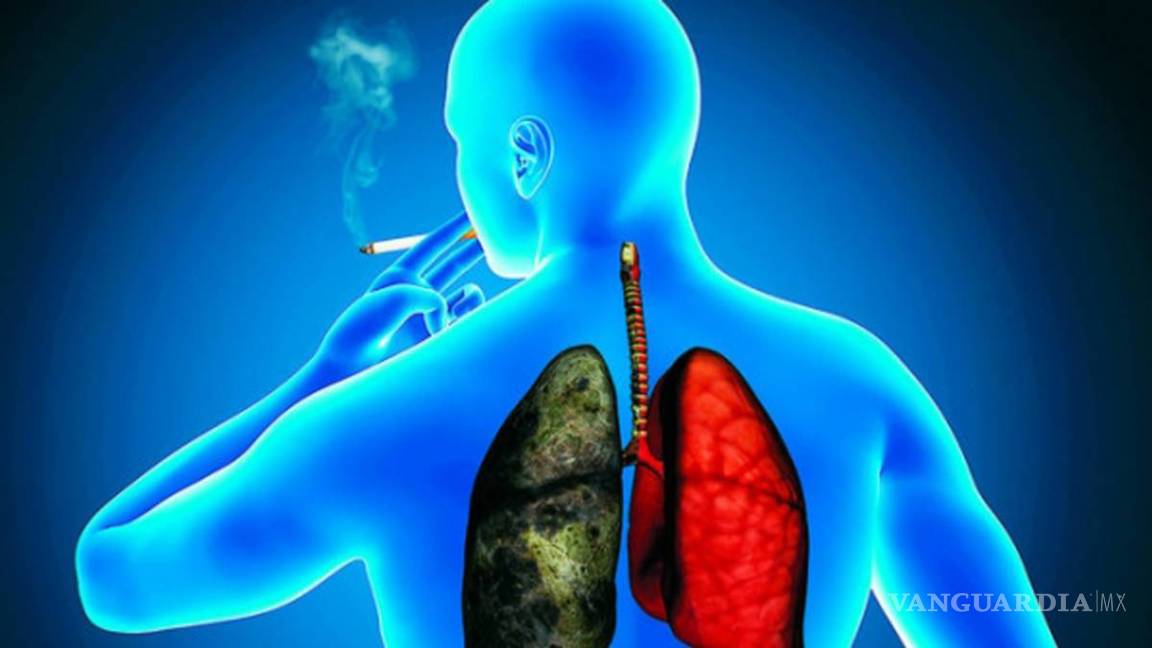 $!Tratamiento con inmunoterapia aumenta la supervivencia en cáncer de pulmón
