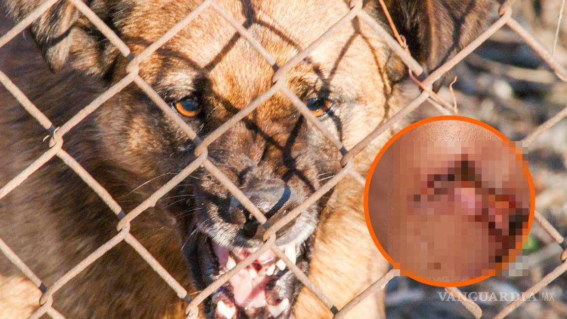 Familia es atacada por perro agresivo en Monclova; dueña se niega a entregar al animal para su resguardo