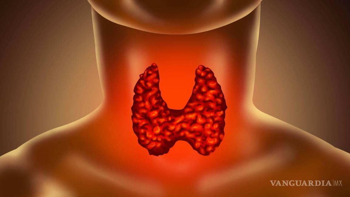 Cuidado, Saltillo: Virus de Papiloma Humano puede causar cáncer de garganta