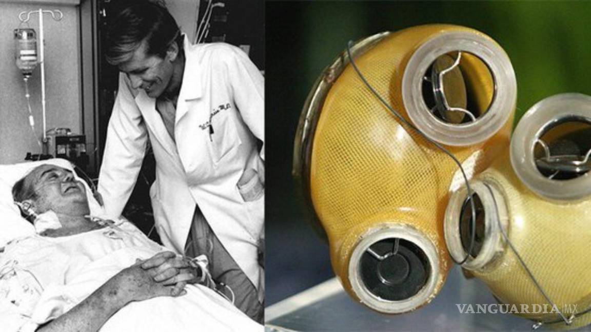Hace 40 años Barney Clark recibió el primer trasplante artificial de corazón