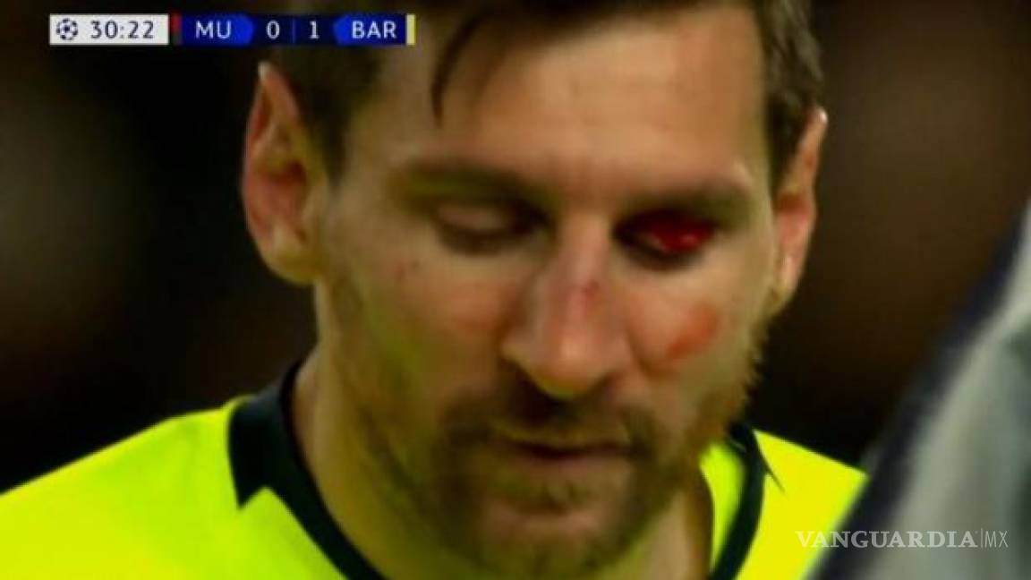 Así quedó el rostro de Messi tras un choque con Smalling