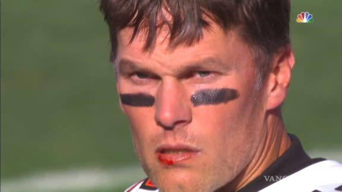 Por primera vez en su carrera, Brady fue castigado por conducta luego de golpe que le cortó el labio