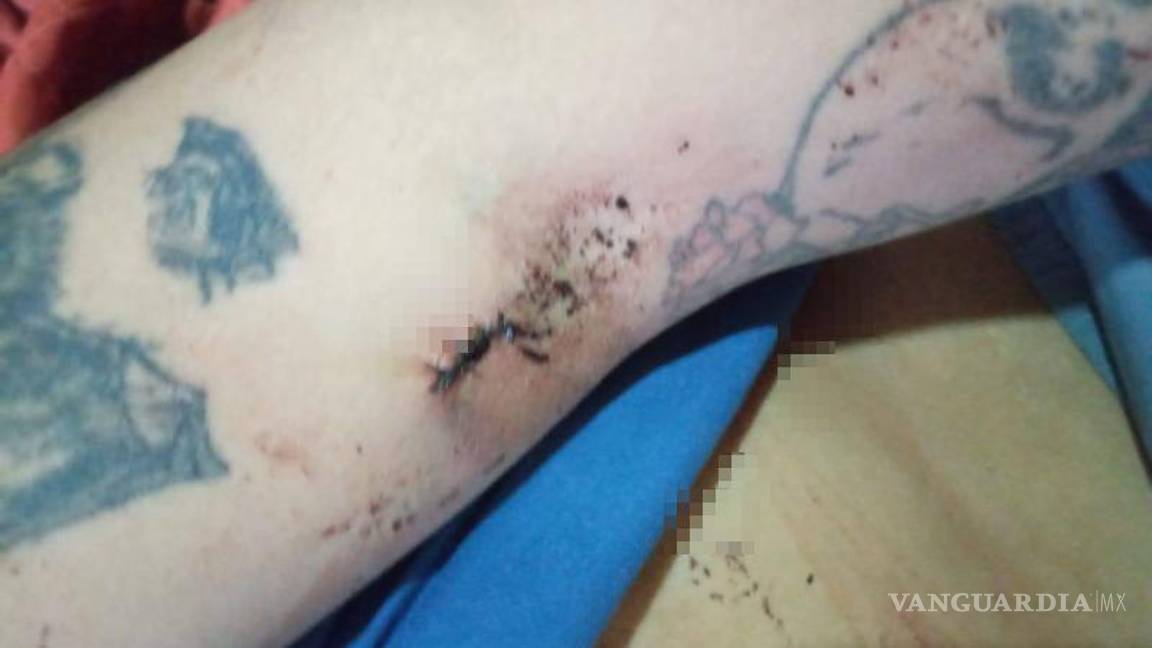 $!El ataque ocurrió cerca del Hospital Ángeles de Torreón; la víctima logró huir malherida y fue hospitalizada de emergencia.