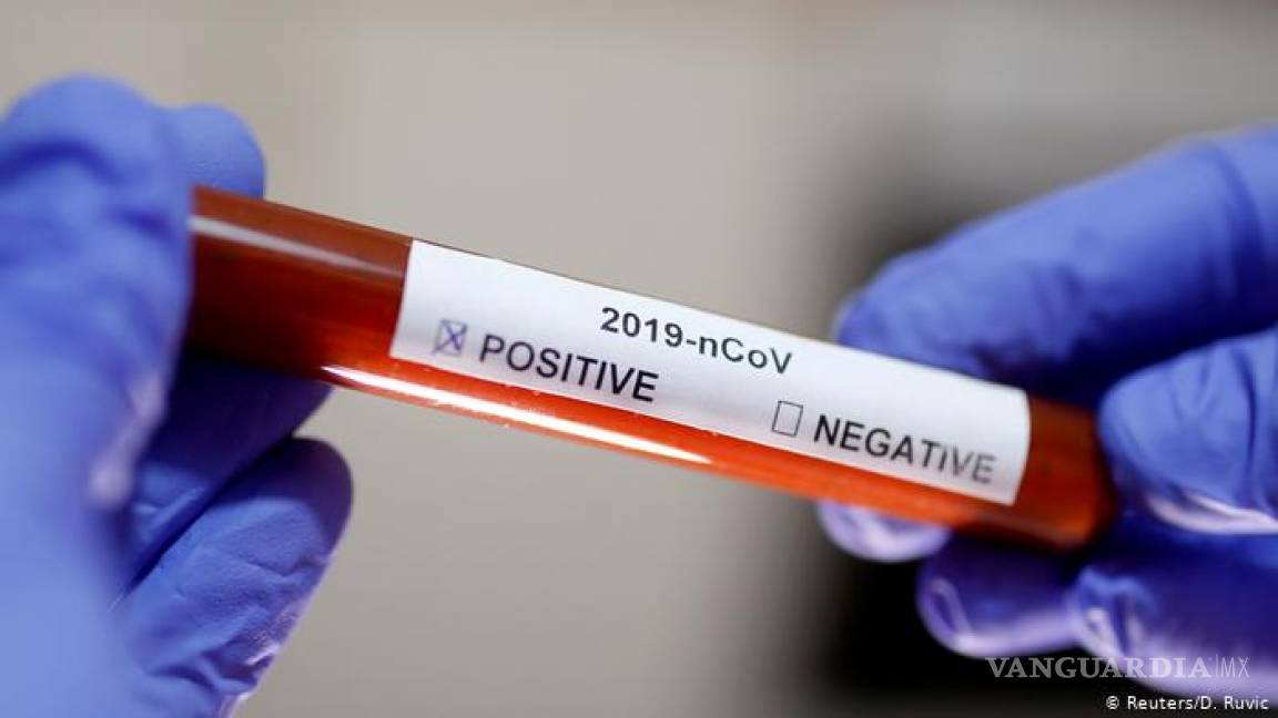 México descarta uso de pruebas rápidas para coronavirus al no ser aprobadas por OMS