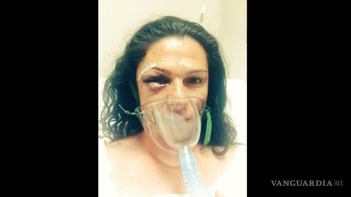 Ana Guevara fue agredida 'por ser mujer en motocicleta'