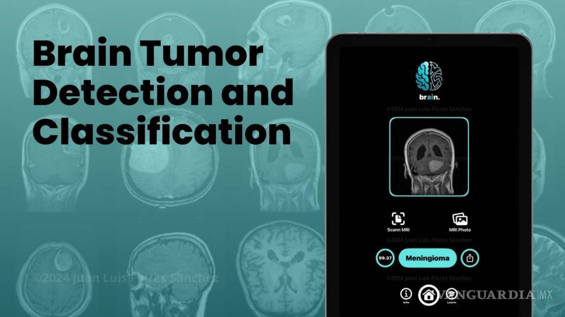 $!La aplicación “Brain” desarrollada por Juan Luis Flores Sánchez, utiliza inteligencia artificial para detectar tumores cerebrales.