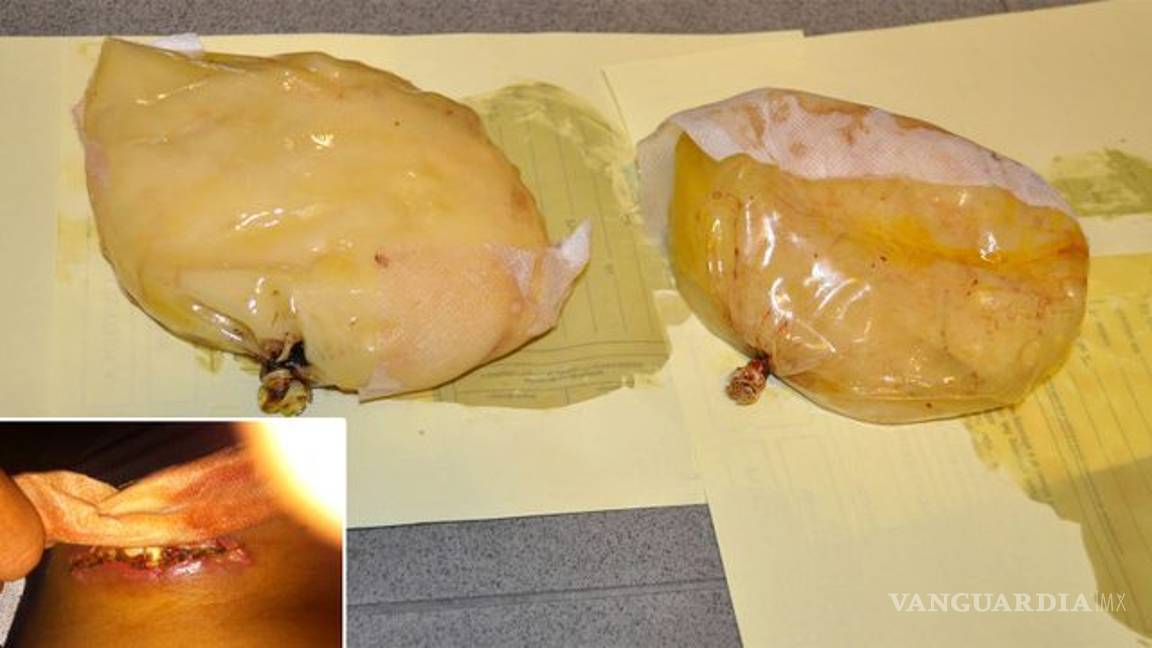 $!Las formas más extrañas en las que los traficantes transportan su droga