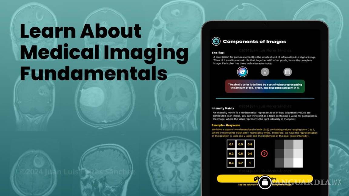 $!Imagen de la interfaz de la aplicación “Brain” en un dispositivo Apple, mostrando su capacidad para analizar imágenes médicas.