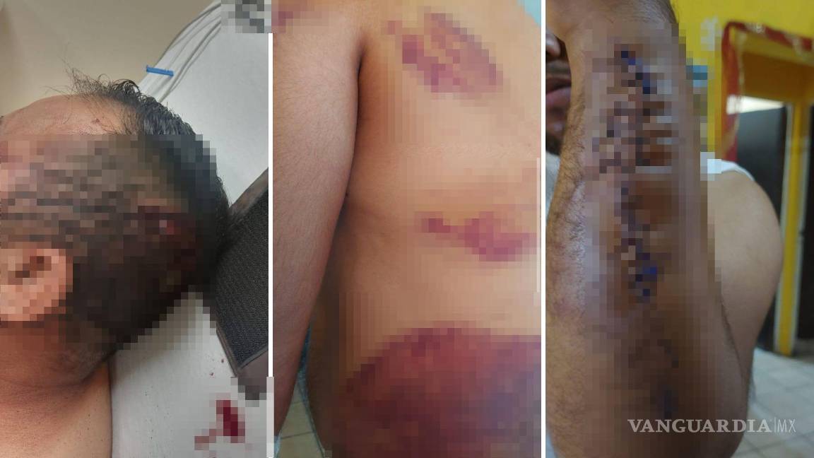 $!Maurilio resultó con fractura de cráneo y brazo tras ser golpeado con bates y navajas, presuntamente por la pareja actual de Wendy.