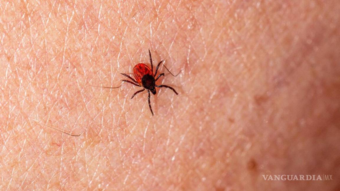 $!Especialistas sugieren atenderse inmediatamente en caso de presentar síntomas de esta enfermedad.