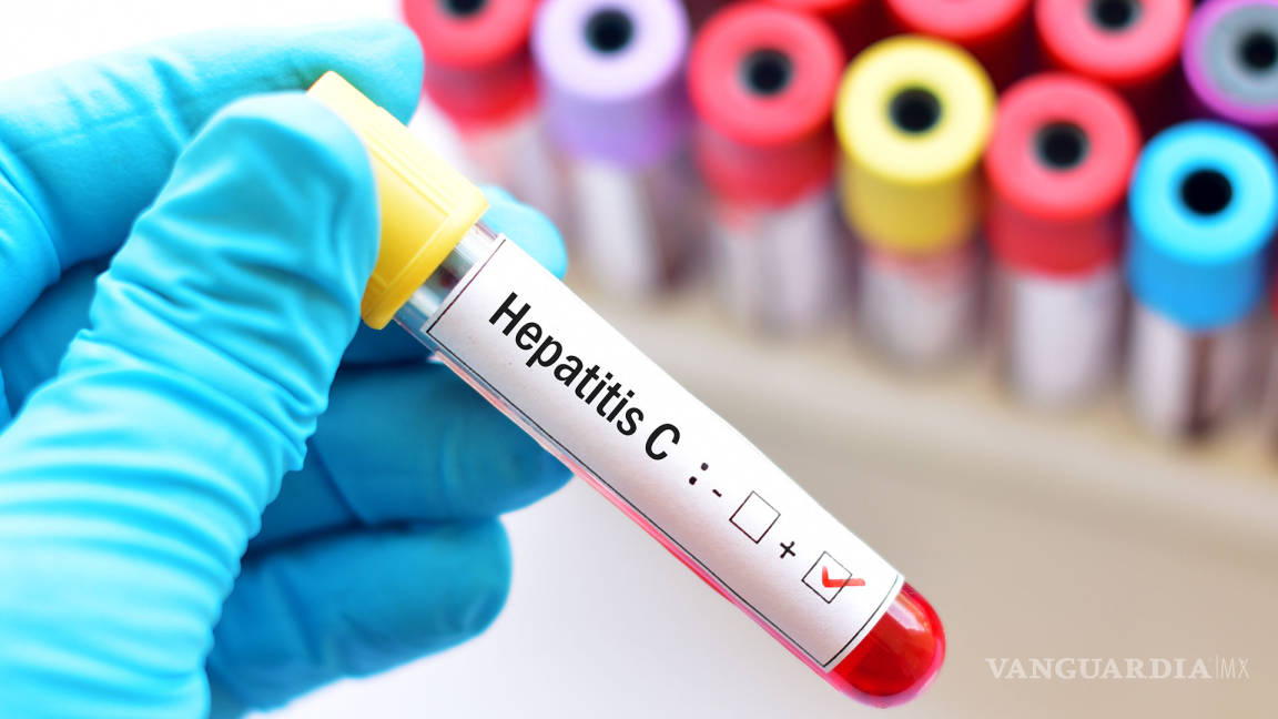 Hepatitis C, una enfermedad silenciosa que puede desarrollar cirrosis o cáncer