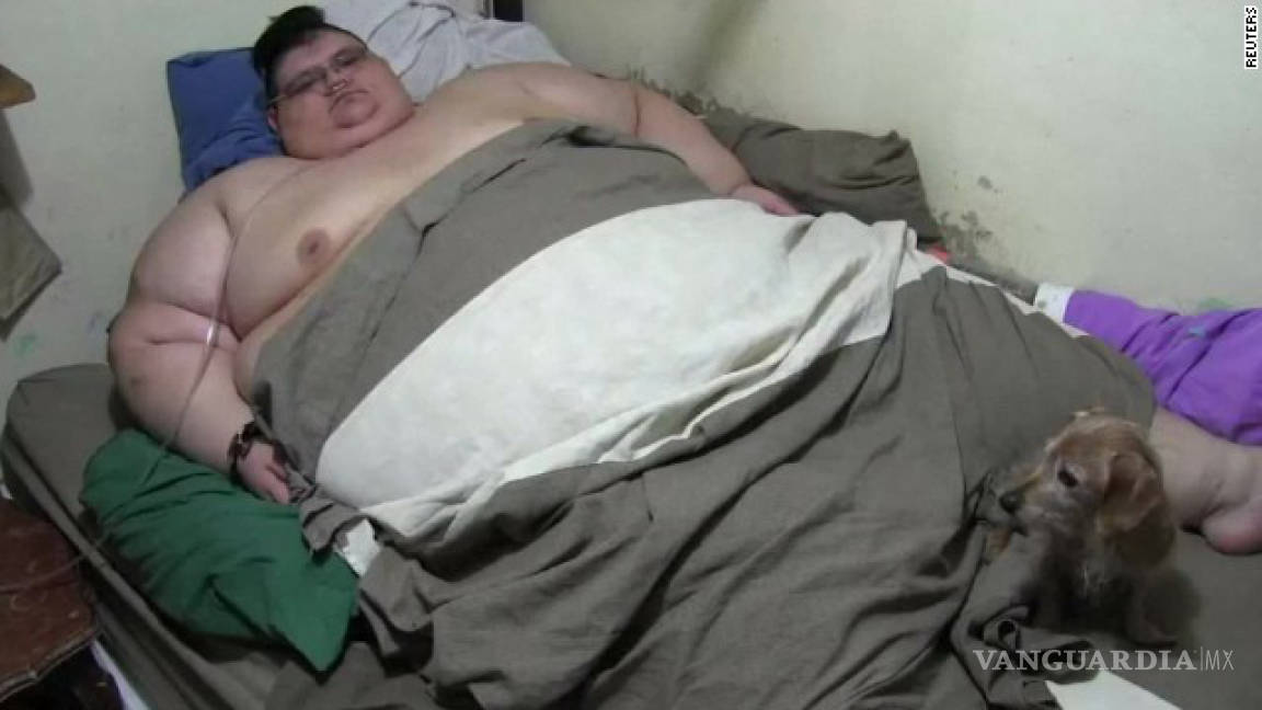 El hombre más obeso del mundo inicia tratamiento en Jalisco para reducir su talla (Video)