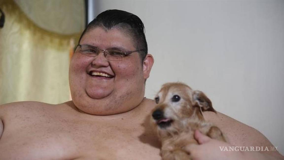 Baja 175 kilos, mexicano considerado el más obeso del mundo