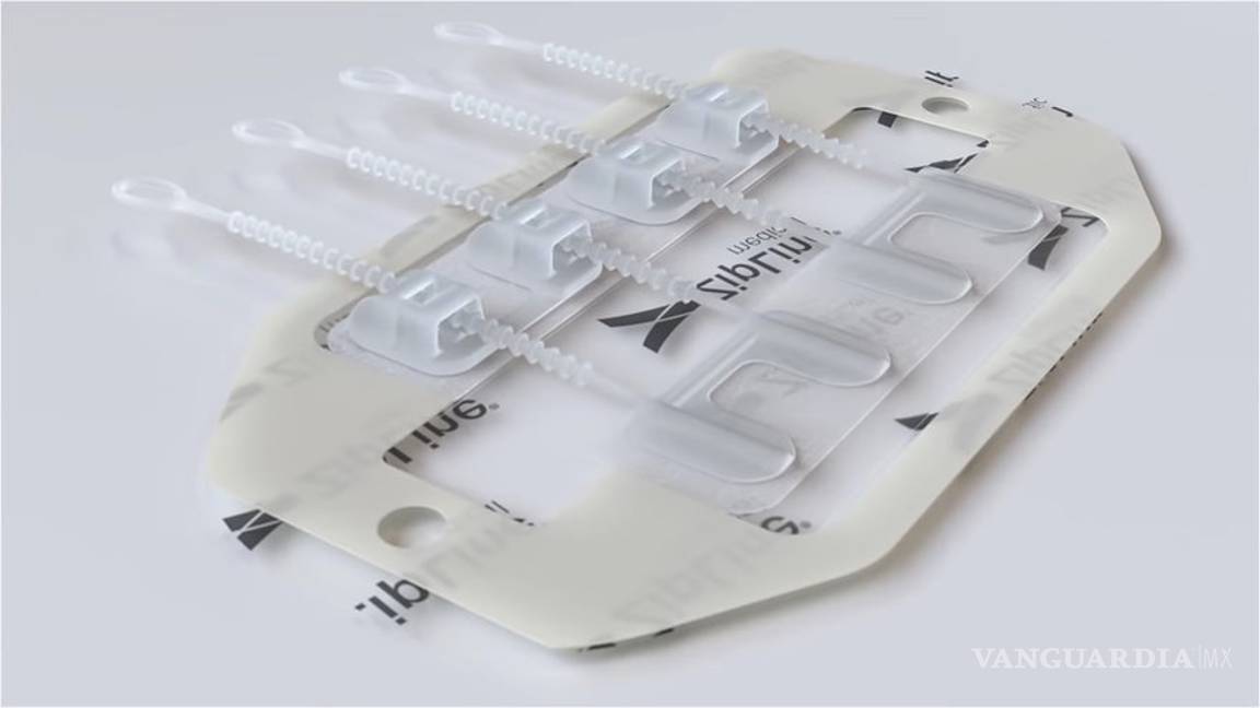 $!ZipStitch, con este dispositivo podrás cerrar heridas sin sutura
