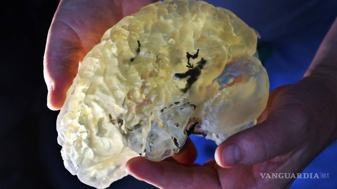 Mexicano en Australia logra cultivar neuronas en mini cerebro impreso en 3D
