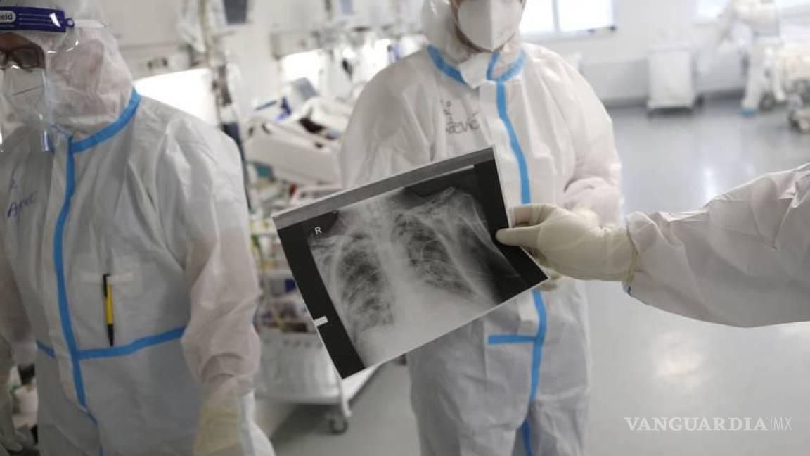 $!Imagen rayos x de pulmones con COVID-19.
