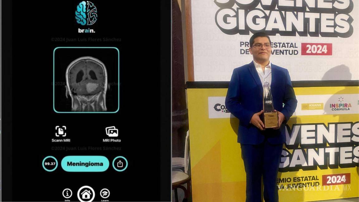 Coahuila: Joven saltillense es reconocido por aplicación que detecta tumores cerebrales