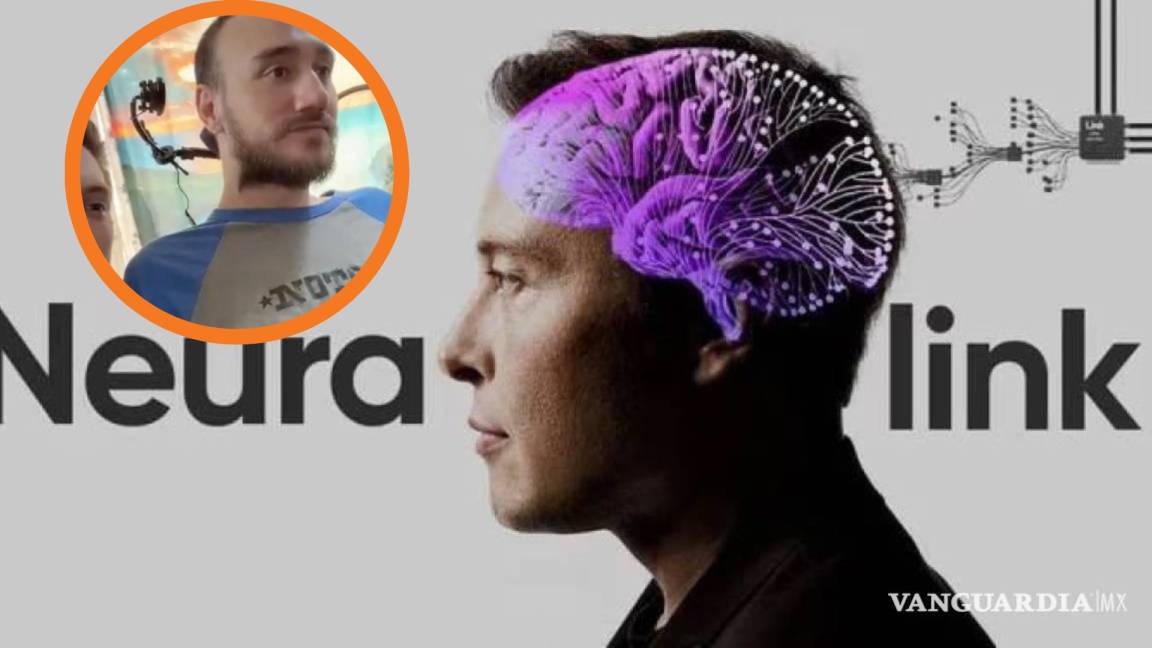 Neuralink: Elon Musk muestra a paciente con parálisis controlar cursor y jugar en línea con la mente