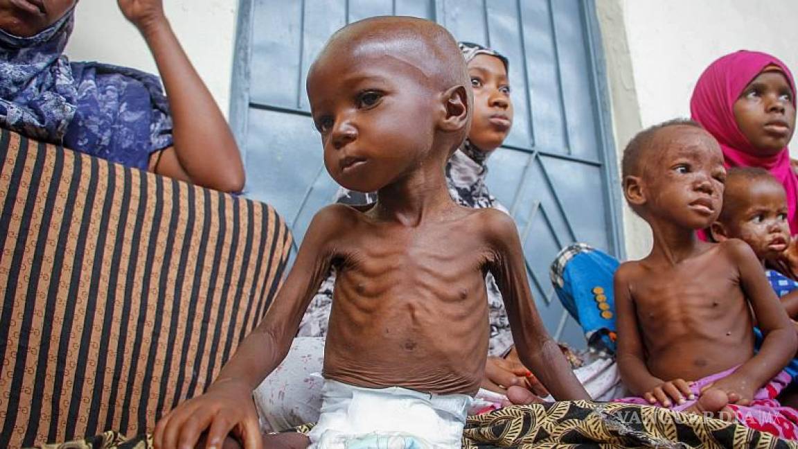 No solo Ucrania sufre, sequía en Somalia ha cobrado la vida de al menos 200 niños desde enero