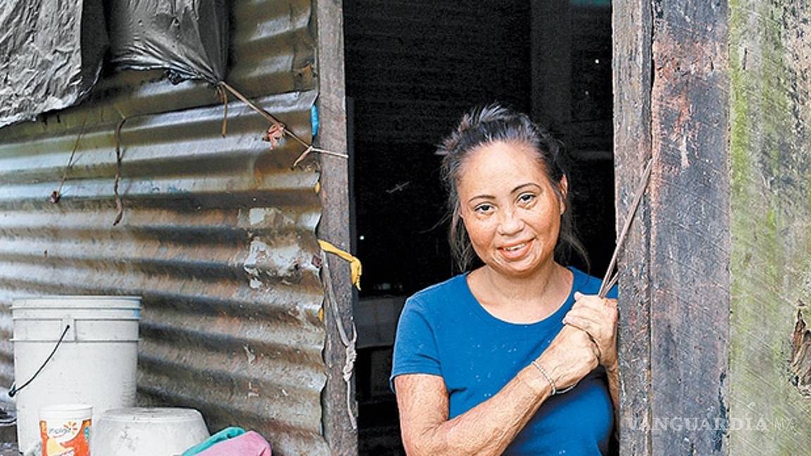$!Quemados por el huachicol... los 19 mil heridos por el fuego en Puebla e Hidalgo